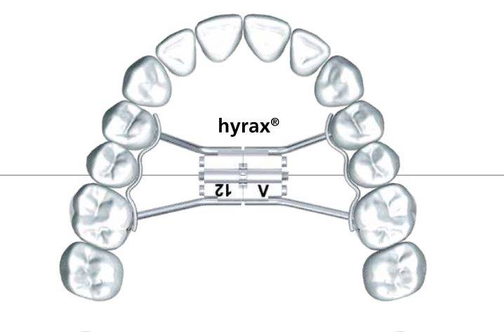 ŚRUBA HYRAX MINI "7" WYGIĘTA 10 szt.