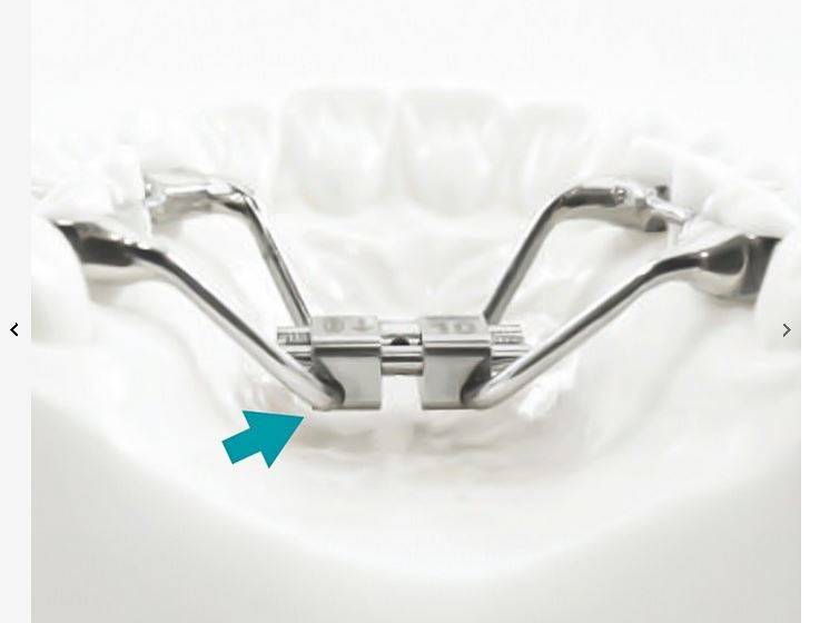 EXPANDER ANATOMICZNY ARMS 12 mm / HYRAX /