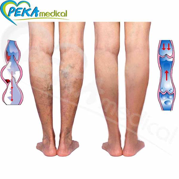 Veera Podkolanówki 140 den grafit 1/2 zamknięte palce przeciwżylakowe uciskowe