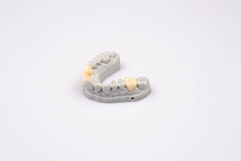 UltraPrint-Dental Temp C&B UV A2  V1.0