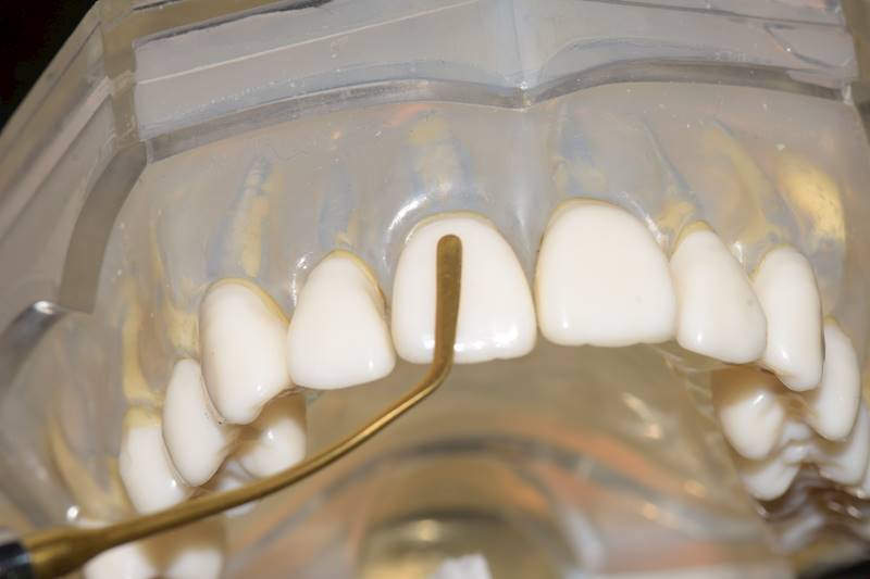 PIF-1