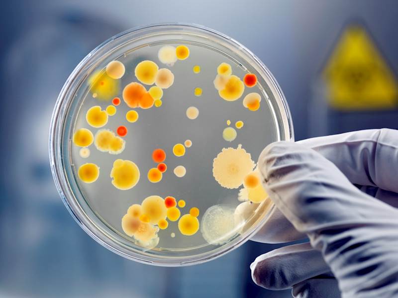 Badanie mikrobiologiczne wody bez przyjazdu próbobiorcy