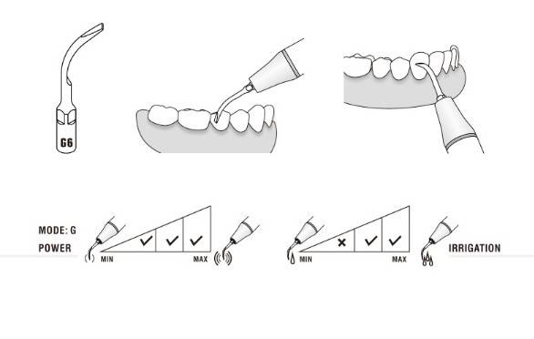 Końcówka do skalera NSK/Satelec GD6 SKALING