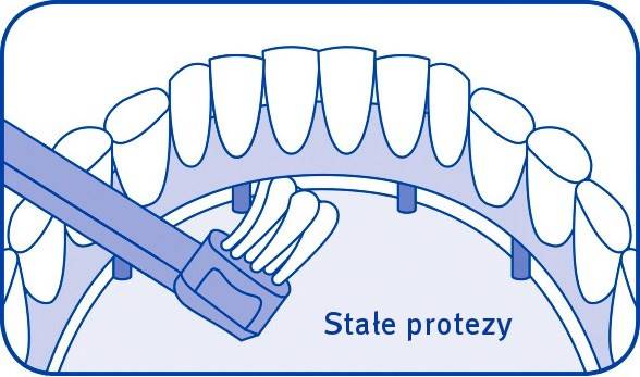 Curaprox szczoteczka IMPLANT CS 708