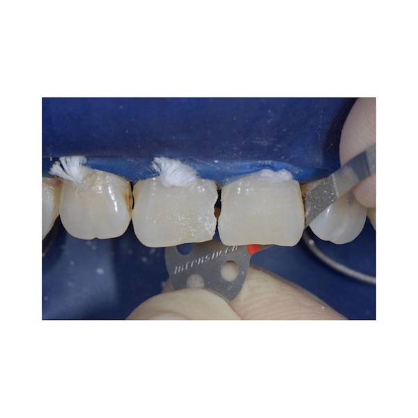 Paski ścierne Intensive ProxoStrip  PX 4015/6 