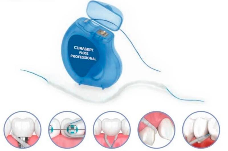 CURASEPT Perfecto nić korony mosty, odcinki 50szt