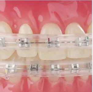 Ochraniacze  na zamki DO.6240.00