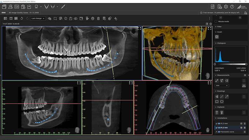 Dürr Dental VistaVox S 2w1 (CT+PANO)