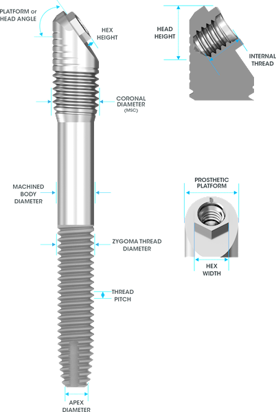 Implant External Hex Zygin 3.4 x 60 mm
