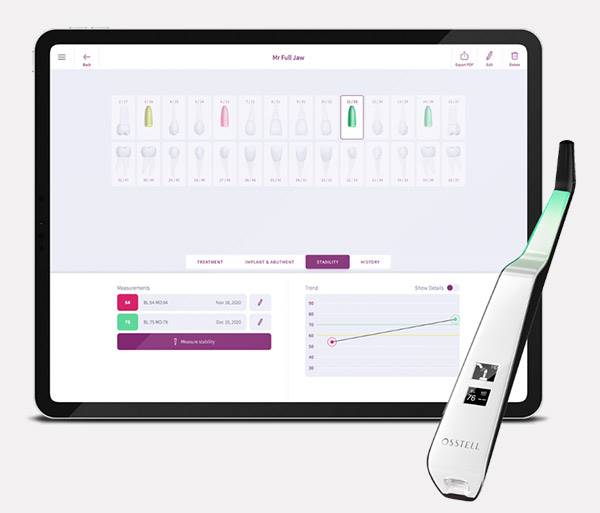 Osstell Beacon – Precyzyjna Ocena Stabilności Implantów od W&H