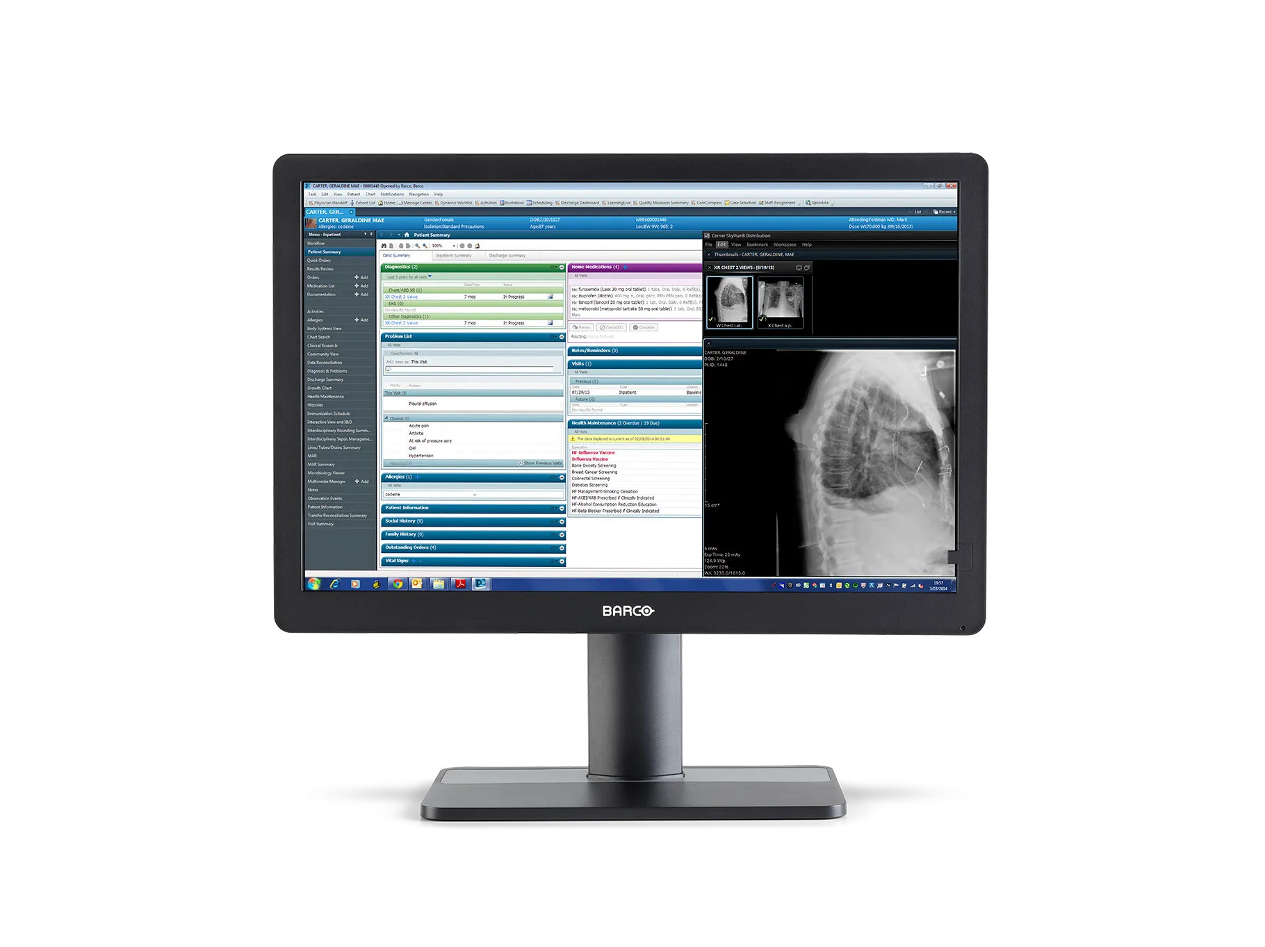 Monitor medyczny BARCO Eonis 24" MDRC-2424 SNIB, 16:10, czarny