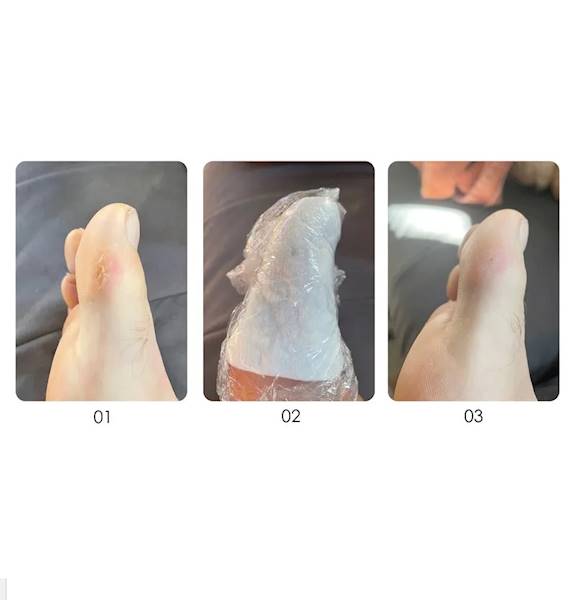 YOKABA Podotherapy burst intensively exfoliating 