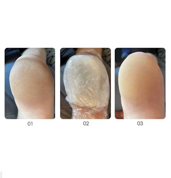 YOKABA Podotherapy burst intensively exfoliating 